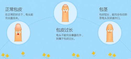 包皮包茎图片,包皮包茎区别,包皮包茎手术,包皮包茎咨询,包皮包茎费用